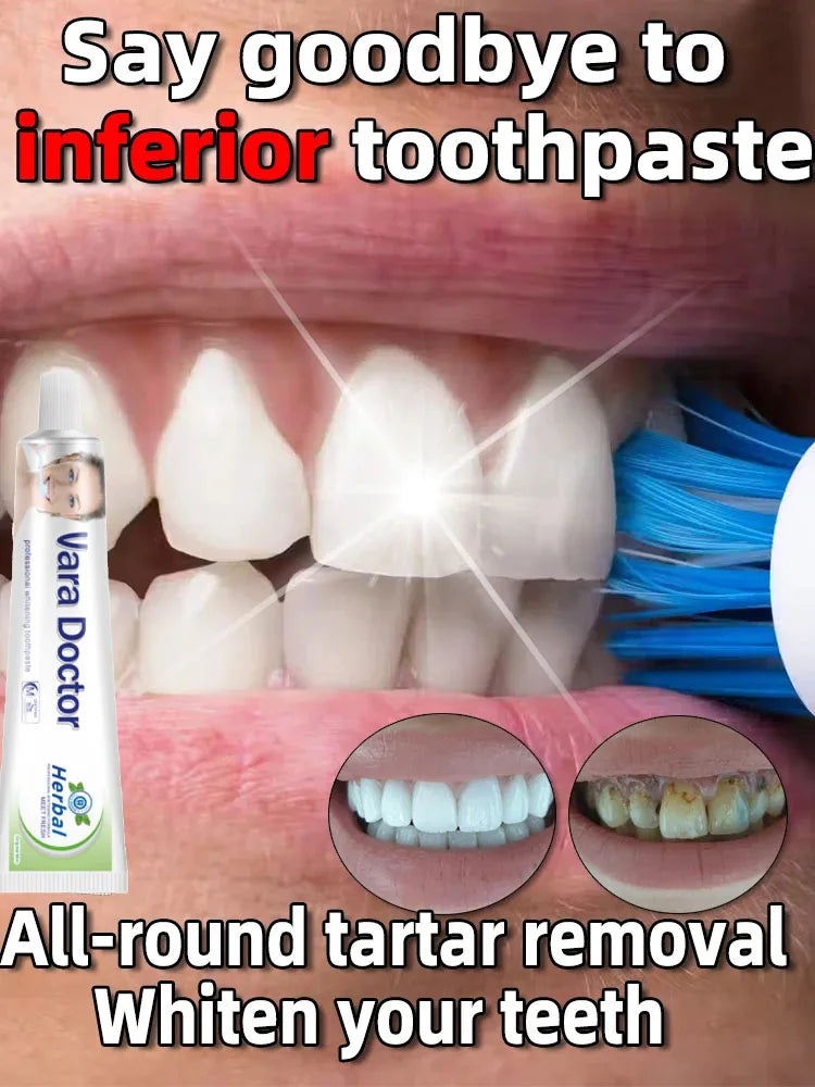 Dental Calculus Remover & Whitening Toothpaste