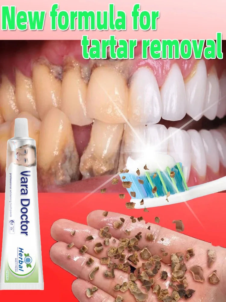 Dental Calculus Remover & Whitening Toothpaste